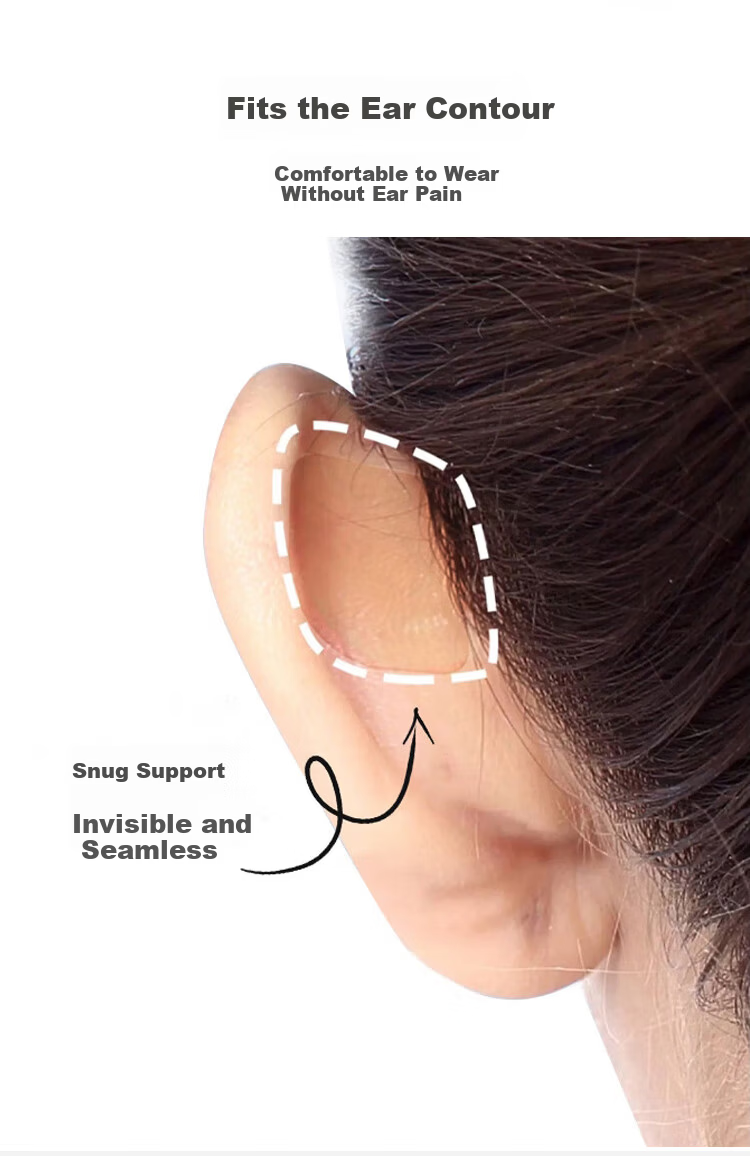 UPLUS Small Chip Spirit Ear Patch 36 Pieces Skin Color Invisible Strong Support Wind-Resistant Ear Lift Waterproof ID Photo 3