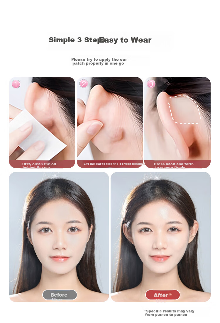 UPLUS Small Chip Spirit Ear Patch 36 Pieces Skin Color Invisible Strong Support Wind-Resistant Ear Lift Waterproof ID Photo 8