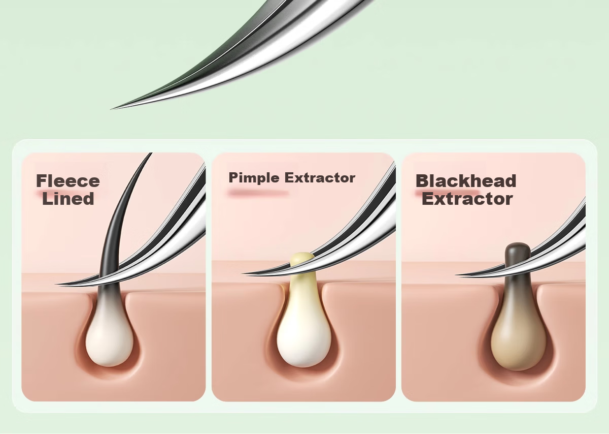 OEIEZ Non-Magnetic Ultra-Fine Comedone Extractor Pimple Tweezer Professional Blackhead Acne Beauty Clamp High-Precision Comedone Tweezer 7