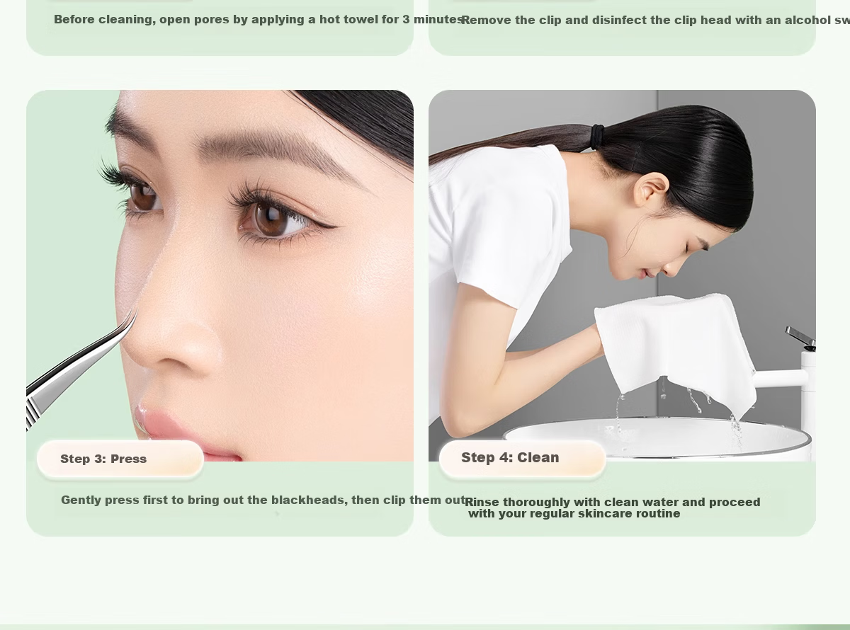 OEIEZ Non-Magnetic Ultra-Fine Comedone Extractor Pimple Tweezer Professional Blackhead Acne Beauty Clamp High-Precision Comedone Tweezer 15