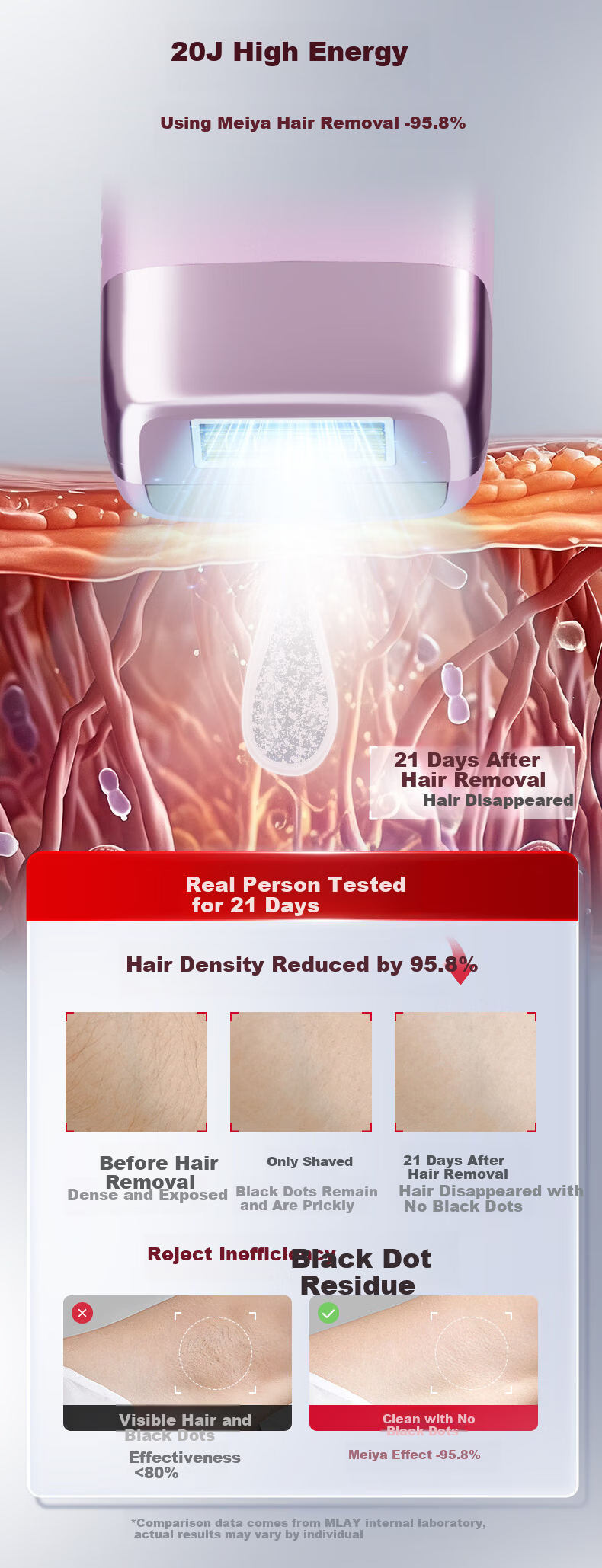 MLAY Beauty Ice Skin Hair Removal Device Home Use Photon Skin Rejuvenation Hair Remover Painless Lip and Underarm Hair Removal Men's Gift Birthday Present for Girlfriend T14Apro Upgraded Version Early 5