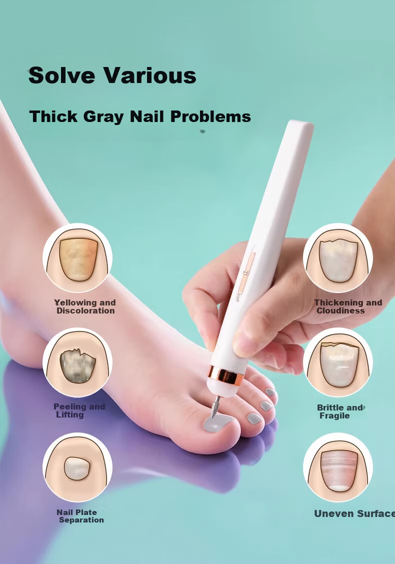 NHGAD Electric Nail Grinder for Onychomycosis Removal Nail Polishing Machine Electric Nail File with Medication Application 3