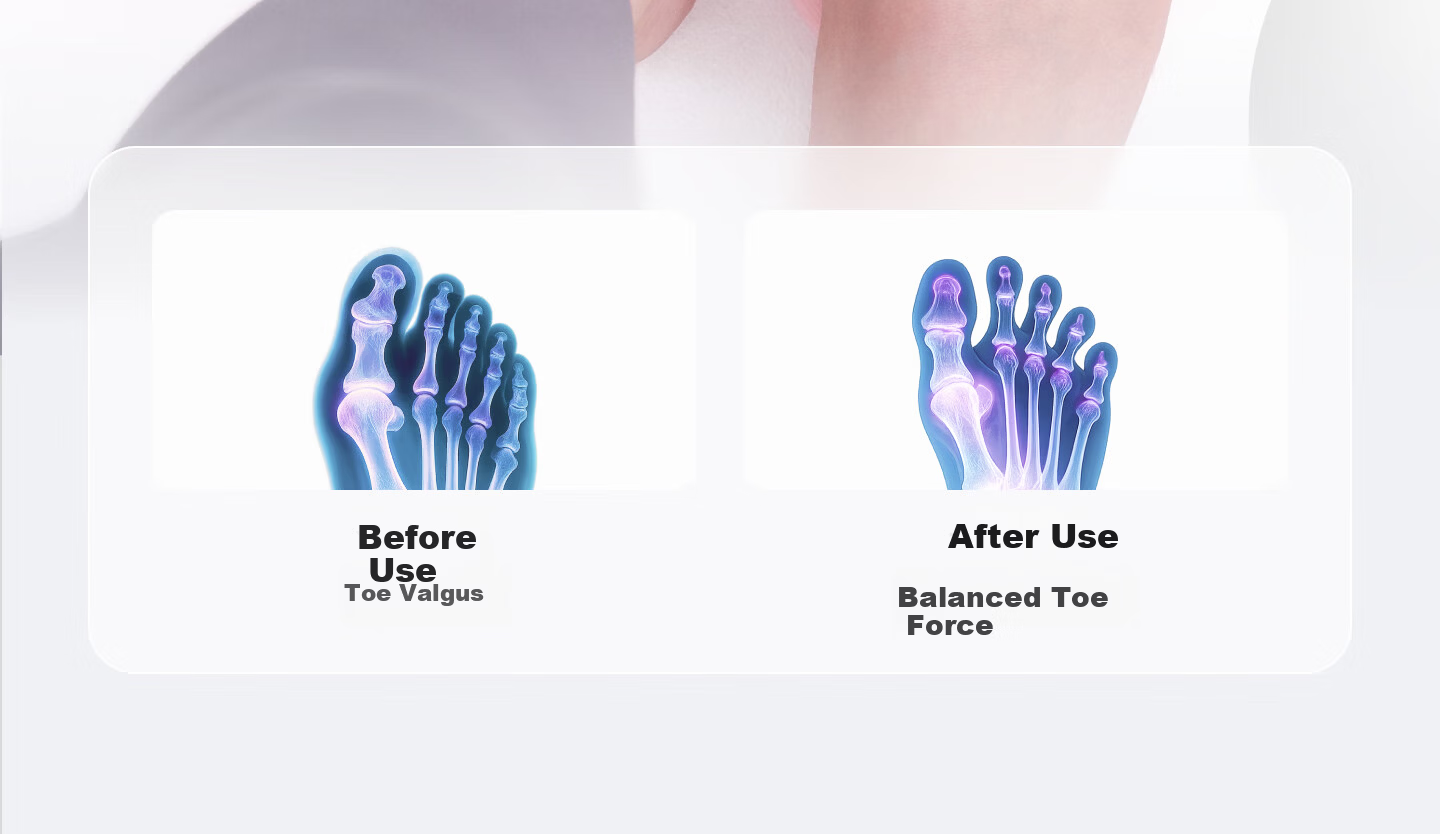 Keep Arch Trainer Leg Slimming Foot Exercise Flat Foot Correction Toe Valgus Aid Sakura Pink 12