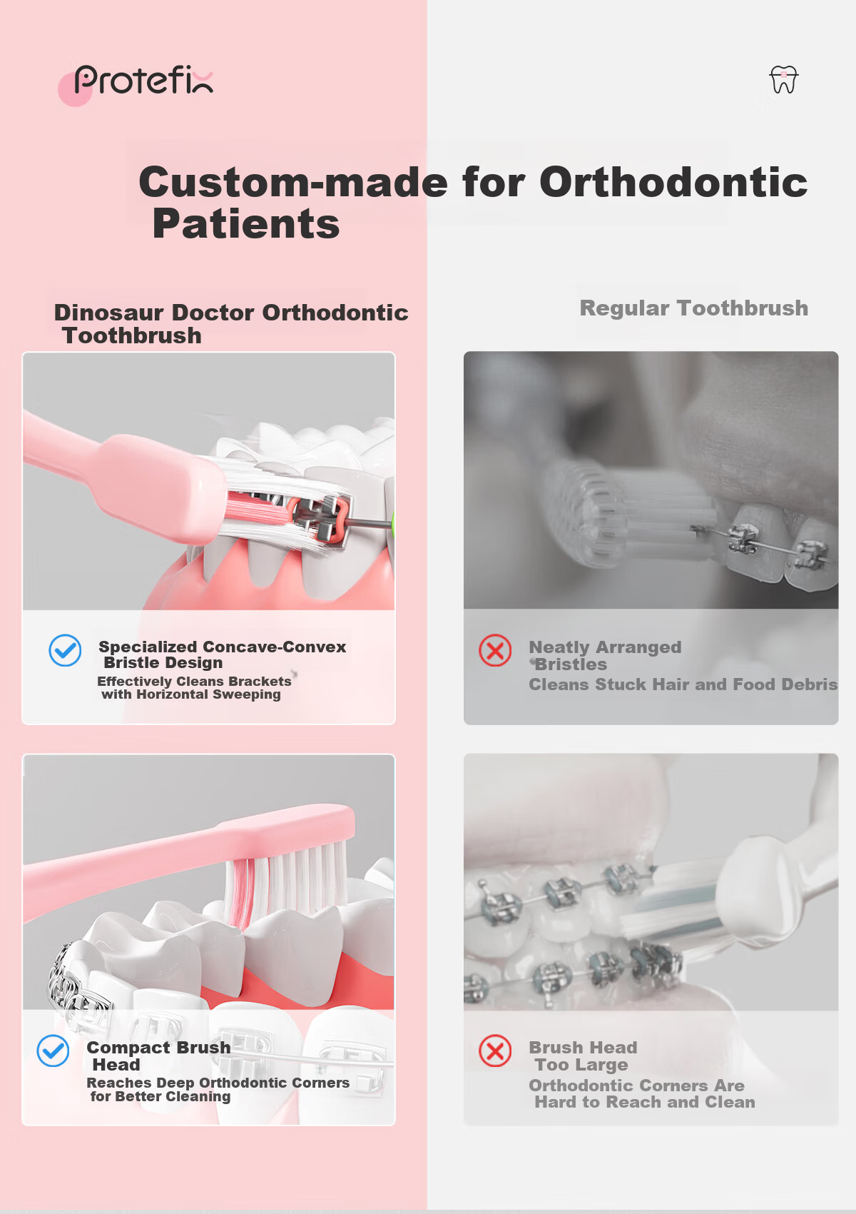 PROTEFIX Orthodontic Concave Toothbrush 4-Pack Soft Bristle Adult Braces Toothbrush Portable Teen Braces Cleaning Brush 3