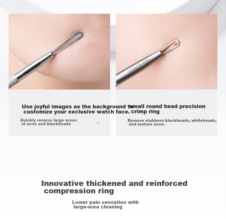 Tweezerman Imported Blackhead Remover No-Needle Design Whitehead Extractor Acne Pimple Tweezer Gift 10