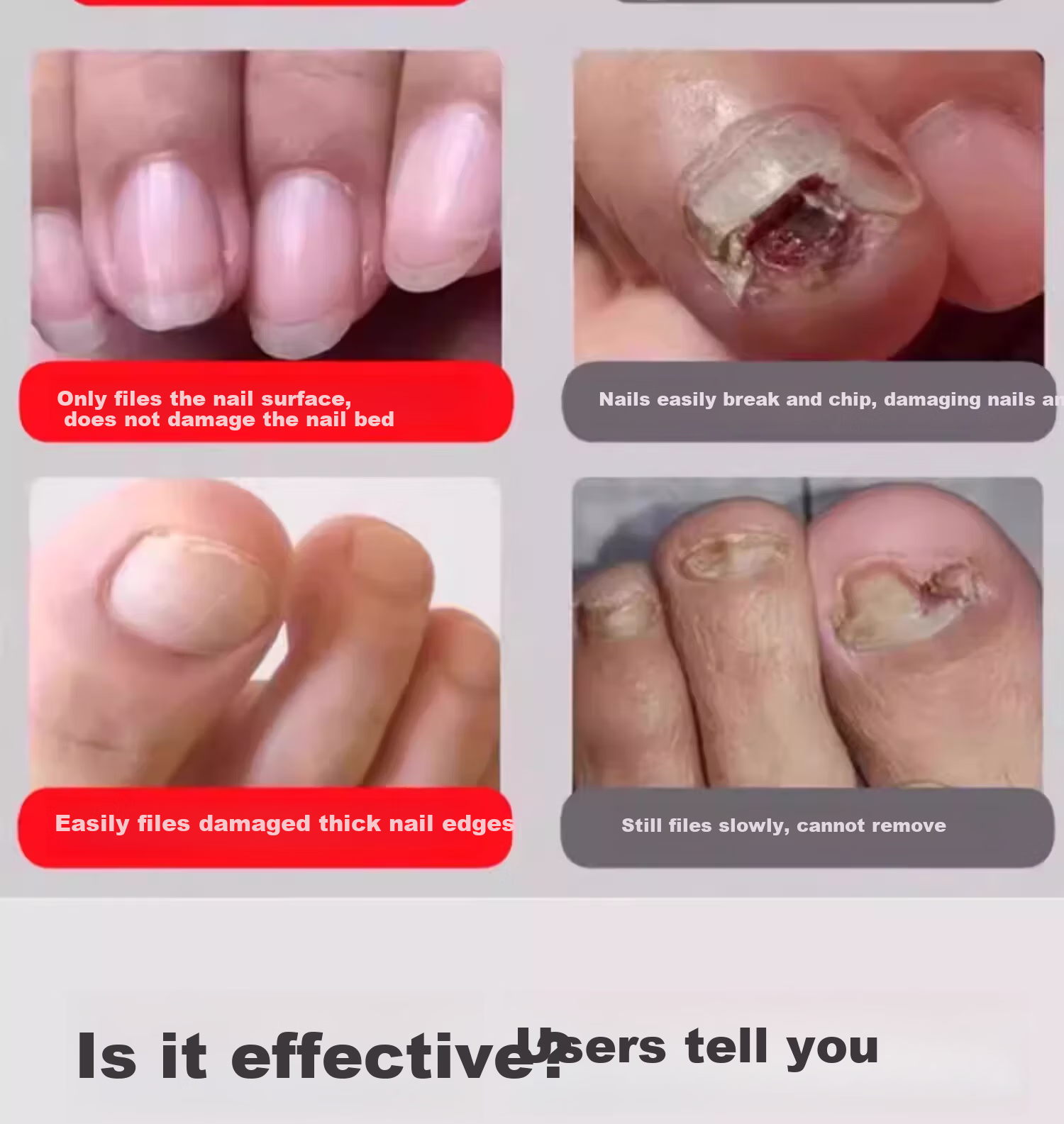 Mattetong Electric Nail Grinder for Onychomycosis Thick Nail Trimmer Automatic Nail Removal Tool 3