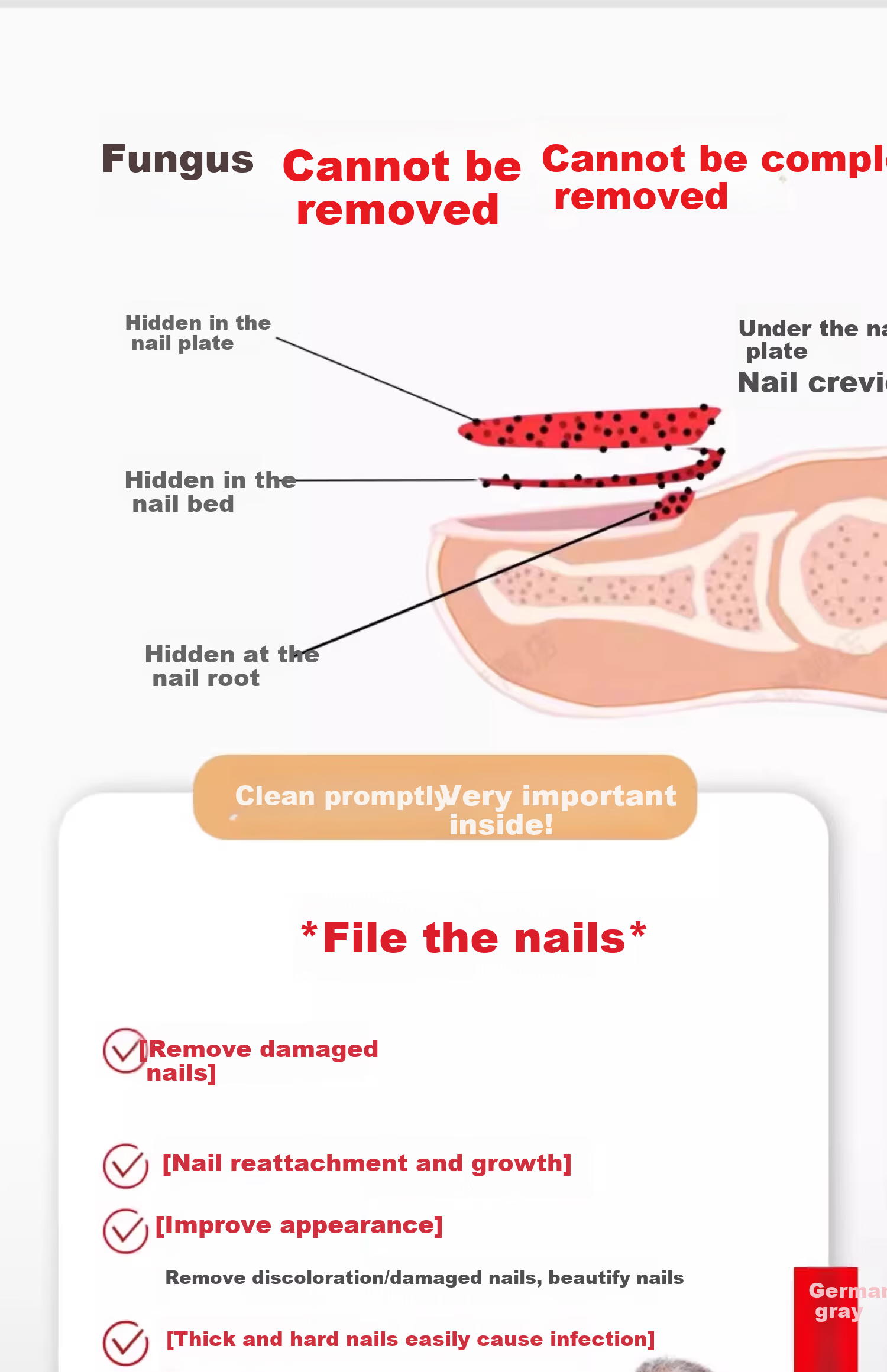 Mattetong Electric Nail Grinder for Onychomycosis Thick Nail Trimmer Automatic Nail Removal Tool 5