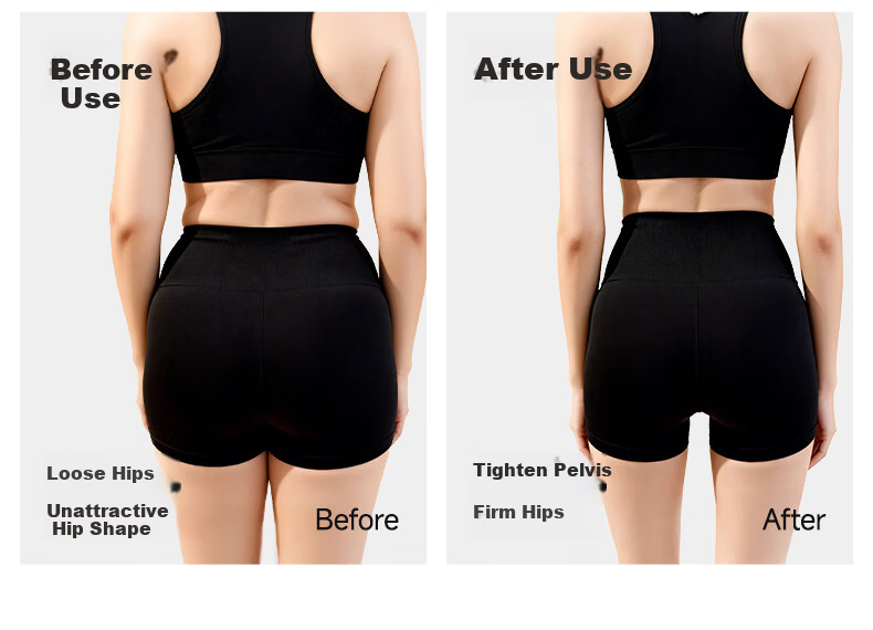 NAILEKESI N Medical Sacroiliac Joint Lumbar Support Belt Postpartum Pelvic Tilt Corrector Tailbone Hip Repair Stabilization Belt M 6