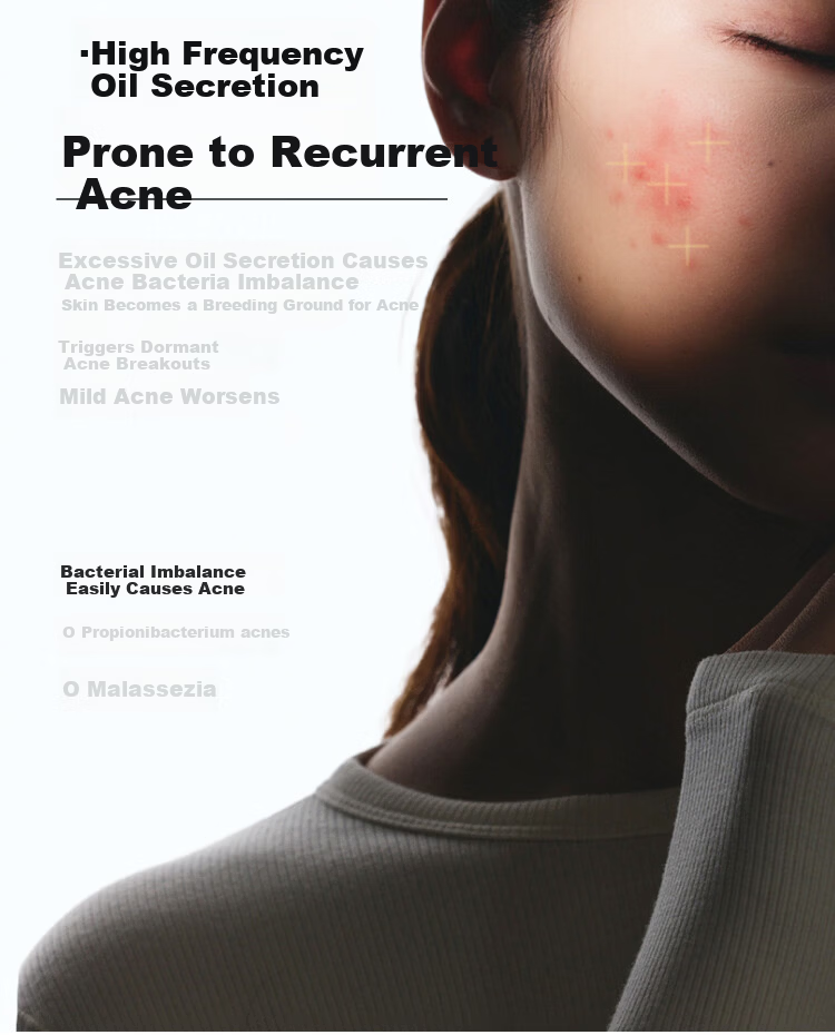 Beneunder Antibacterial Protective Mask Physical Acne Control Sunscreen Breathable Unisex Sensitive Acne Skin Specialized Mask 5