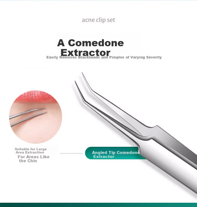 Keqi Double-Ended Blackhead and Acne Extractor Tool Set, 5 Pieces 6
