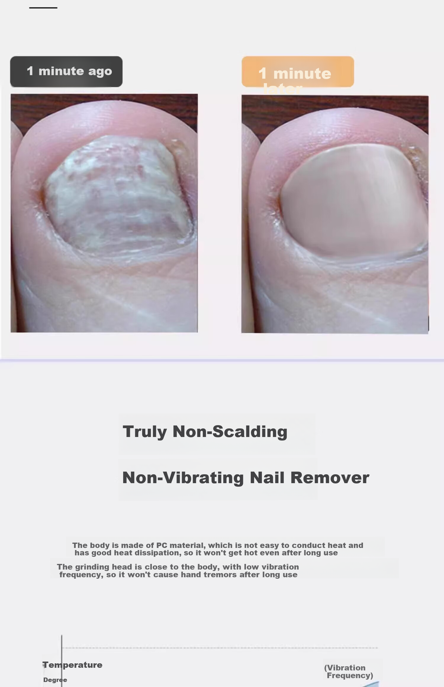 Mattetong Electric Nail Grinder for Onychomycosis Thick Nail Trimmer Automatic Nail Removal Tool 8