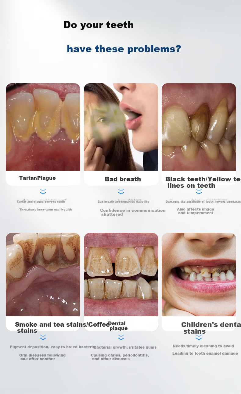 Moon Crescent Ultrasonic Teeth Cleaner M1 Pro Visual Tooth Tartar Remover Dental Cleaner Yellow Stain Remover Gift for Husband Boyfriend 4