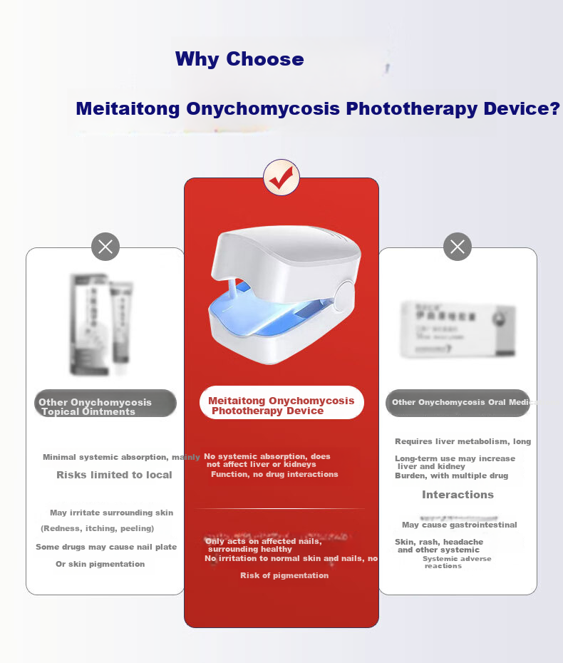 Mattetong Gray Toenail Phototherapy Lamp Smart Gray Toenail Laser Fungus Treatment Device Foot Nail Sterilization Lamp 2