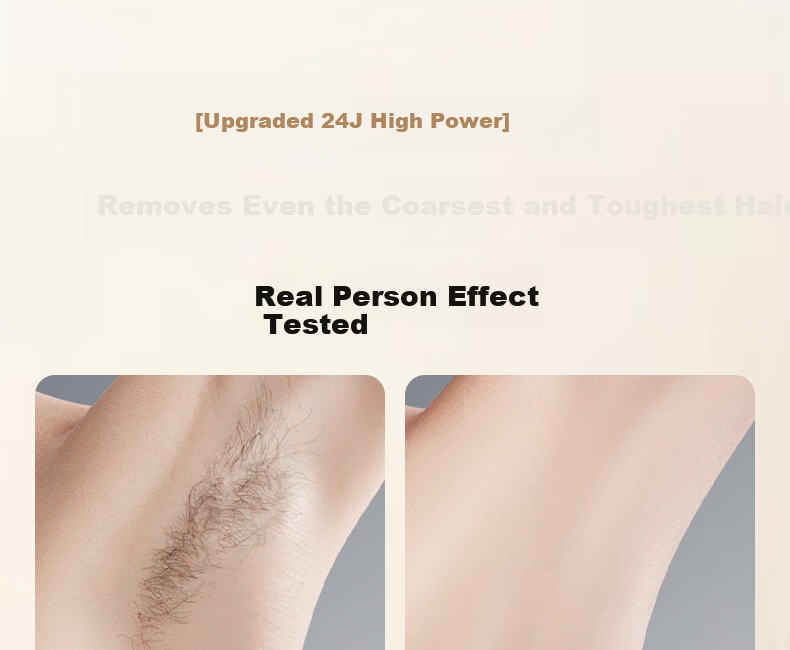 AUX Hair Removal Device Dual Lamp Sapphire Ice Point Full Body Underarm Private Use Home ProMax 24J Valentine's Day Gift High Power 8