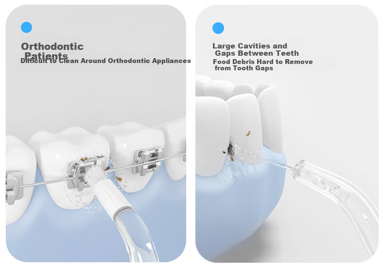 Bayer [618 Lowest Price Sale] Professional Portable Handheld Ultrasonic Water Flosser Teeth Cleaning Device Set (M4+V6 Ocean Blue Dream) 8