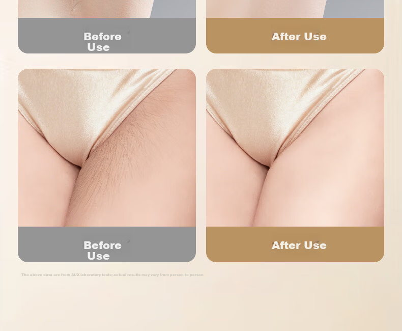 AUX Hair Removal Device Dual Lamp Sapphire Ice Point Full Body Underarm Private Use Home ProMax 24J Valentine's Day Gift High Power 9