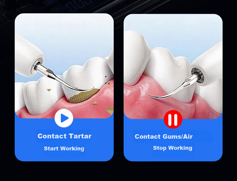 Lenovo Ultrasonic Dental Cleaner Teeth Tartar Remover Oral Irrigator Yellow Stain Tartar Cleaning Plaque Polishing Tool Medical Home Use JD Self-operated 12
