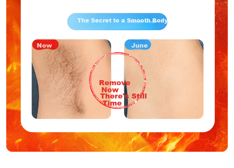 Lenovo Sapphire Hair Removal Device High Power Ice Point Private Area Lip Armpit Full Body Bikini Unisex Home Use Body Shaver Mother's Day Girlfriend 520 Gift 4
