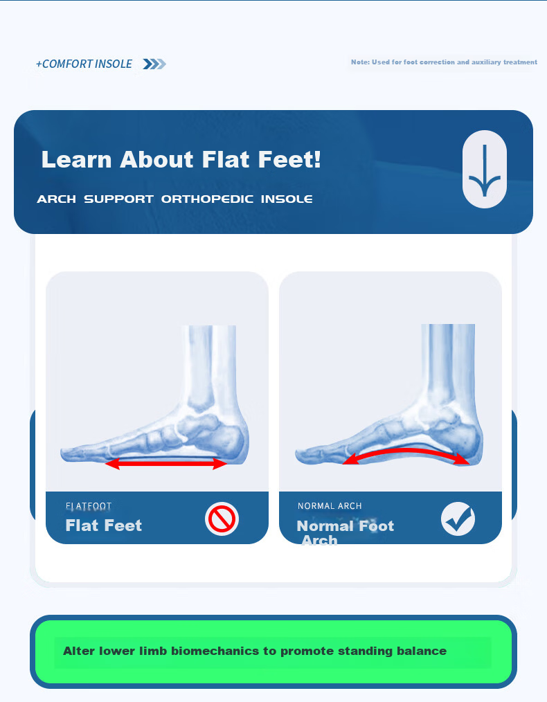 3AnGnI Correction Insoles Flat Foot Sports Support Insoles Bowleg Calf Outward Deviation Shock Absorption Pads M-Shaped Size 42 9