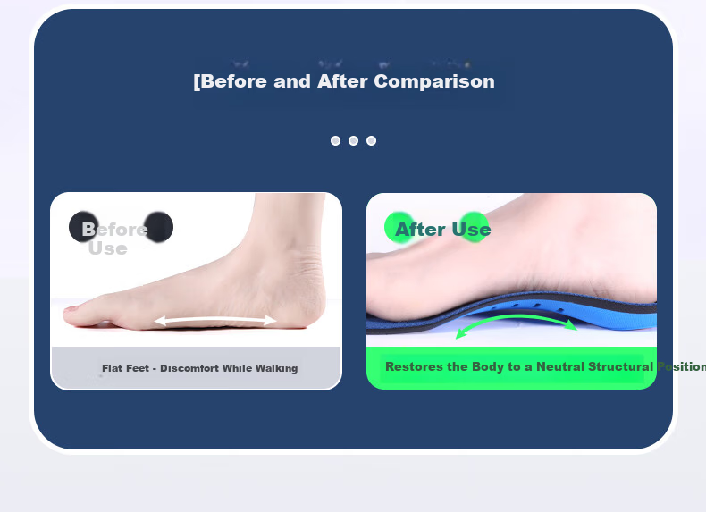 3AnGnI Correction Insoles Flat Foot Sports Support Insoles Bowleg Calf Outward Deviation Shock Absorption Pads M-Shaped Size 42 5