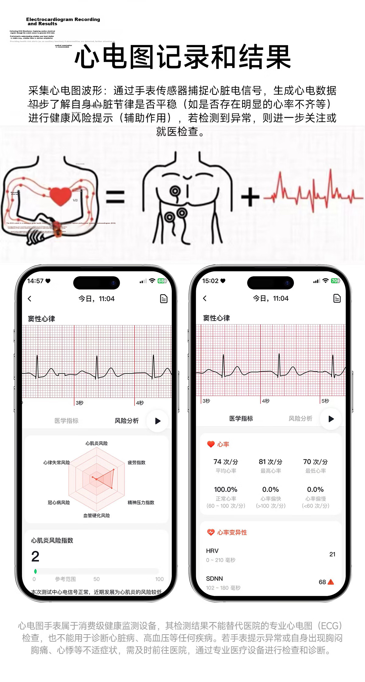EG Smartwatch AI Multifunctional Heart Rate Health Sports HD Waterproof Watch Blood Oxygen Blood Pressure Body Fat Monitoring Bracelet 6