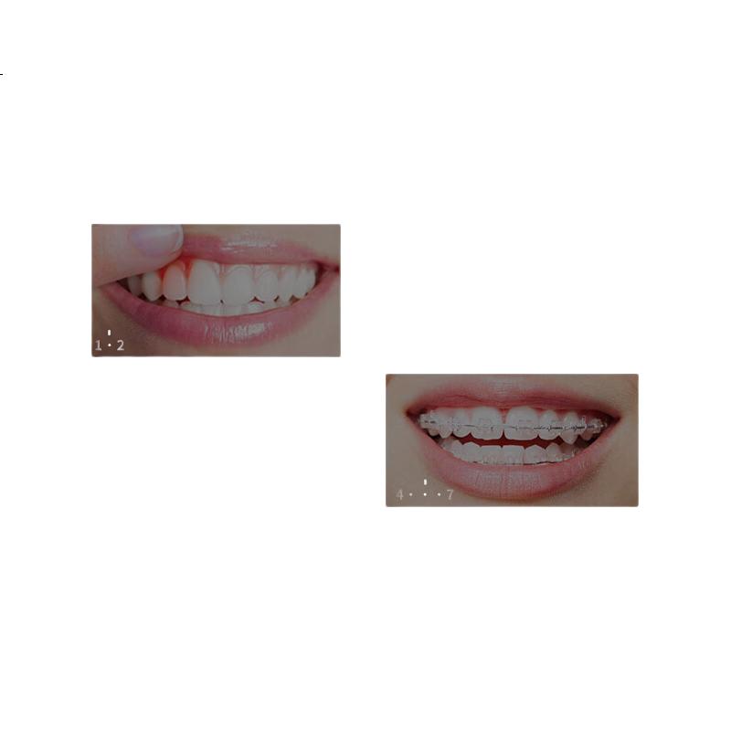 White Image 3