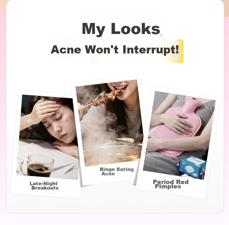 Yusu Acne Patch Star-Shaped Concealer Invisible Acne Sticker Cute Pimple Patch Makeup-Friendly Birthday Gift for Men and Women 2