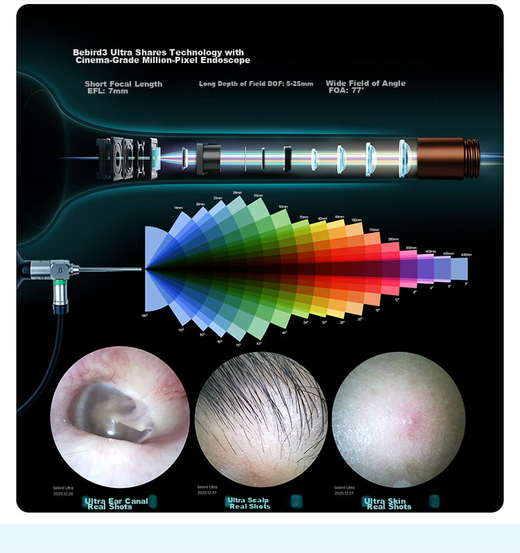 Bebird 3 UltraX Visual Ear Cleaner Hummingbird 2K HD Ear Care Device Birthday Gift Premium Gift Box 10