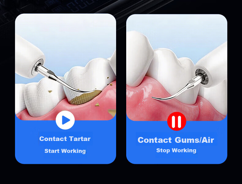 Lenovo Ultrasonic Dental Cleaner Teeth Tartar Remover Oral Irrigator Yellow Stain Tartar Cleaning Plaque Polishing Tool Medical Home Use JD Self-operated 15