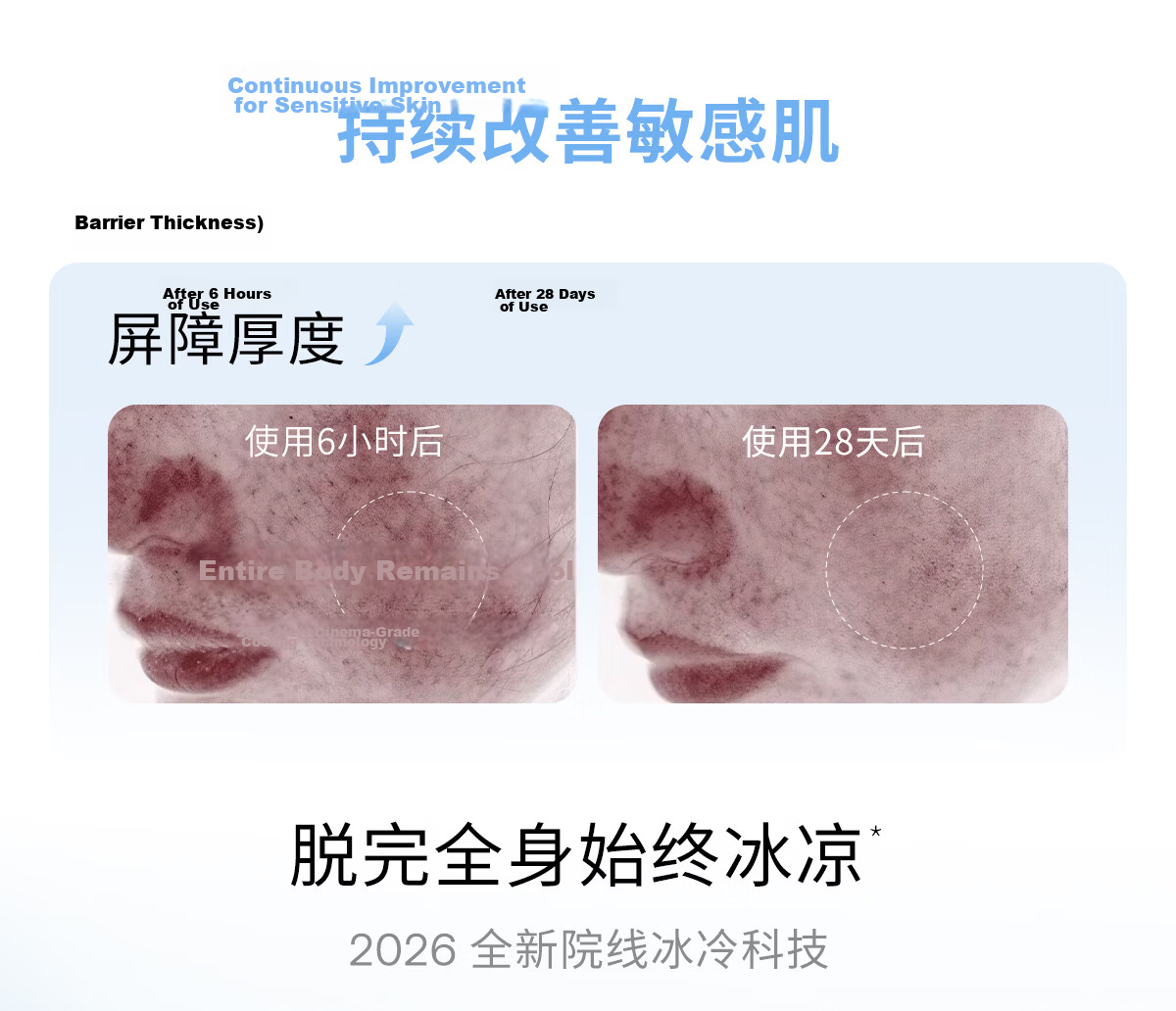Ulike Air20 Photon Ice Point Sapphire Hair Removal Device Full Body Hair Removal Smart Skin Detection Suitable for Men and Women Private Areas 16
