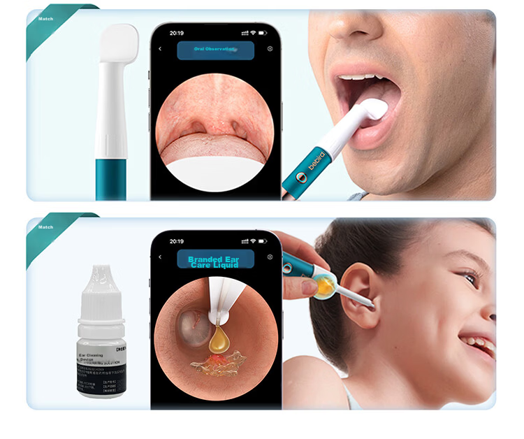 Bebird 3 UltraX Visual Ear Cleaner Hummingbird 2K HD Ear Care Device Birthday Gift Premium Gift Box 40
