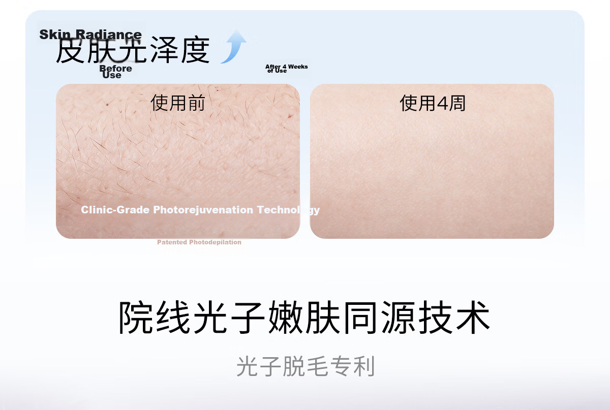 Ulike Air20 Photon Ice Point Sapphire Hair Removal Device Full Body Hair Removal Smart Skin Detection Suitable for Men and Women Private Areas 12