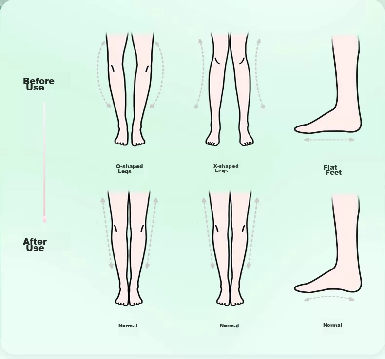 Dog Brother Whale Arch Support 3/4 Length Insoles Flat Foot Correction Men's Half Insoles Size 43-44 Pair 3