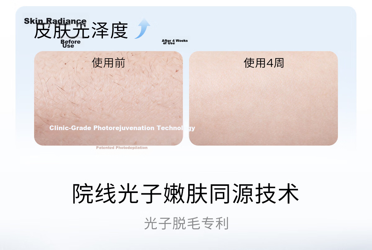 Ulike Air20 Photon Ice Point Sapphire Hair Removal Device Full Body Hair Removal Clinic Use Beard Hair Remover Shaver Intelligent Skin Analysis 12