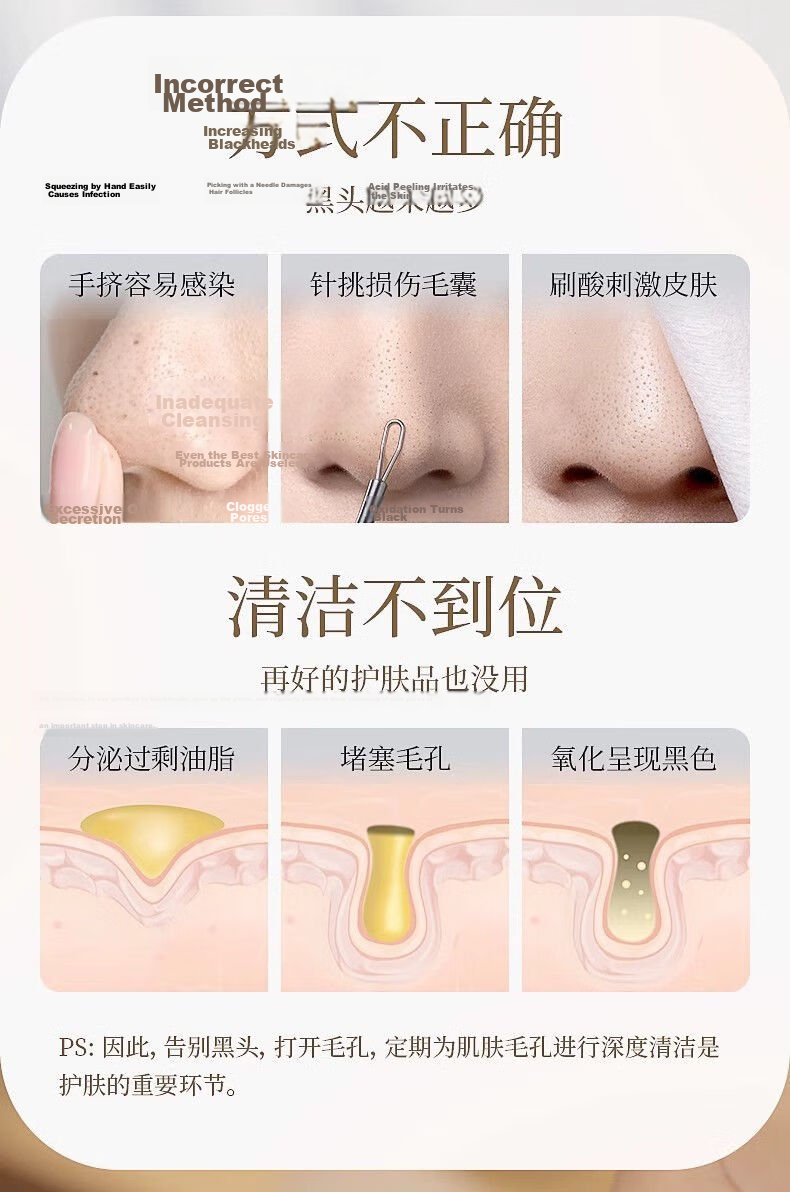 Jianyingshu Ultra-Fine Tweezers, Acne Blackhead Extractor, Beauty Tweezers, Comedone Extractor, Pimple Remover 2