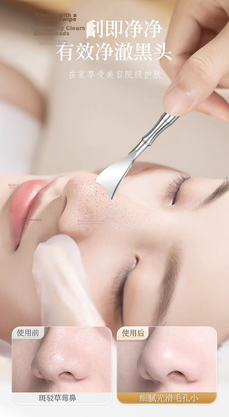 Jianyingshu Ultra-Fine Tweezers, Acne Blackhead Extractor, Beauty Tweezers, Comedone Extractor, Pimple Remover 3