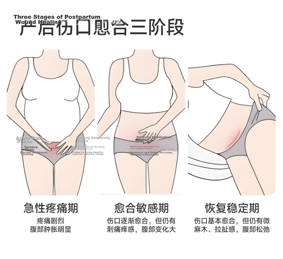 JOYNCLEON Postpartum High-Waist Cotton C-Section Maternity Underwear Extended Crotch Tummy Control Vertical Seam L Jnk196770 4