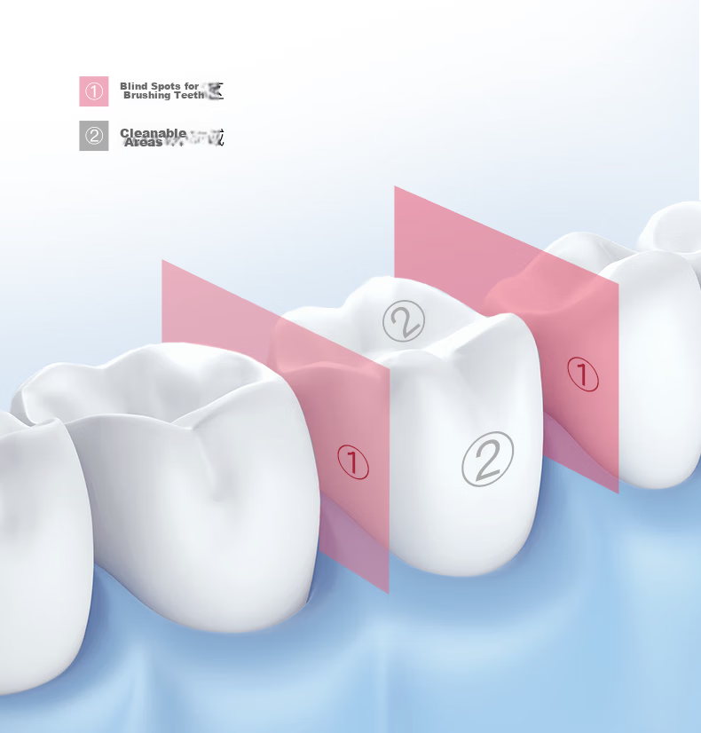 BAIR Xiaomi Bao Portable Water Flosser, Retractable Pull-Type Large Water Tank, for Home Use And Orthodontic Treatment, Oral Irrigation Device, M9 Bujiao Gree 7