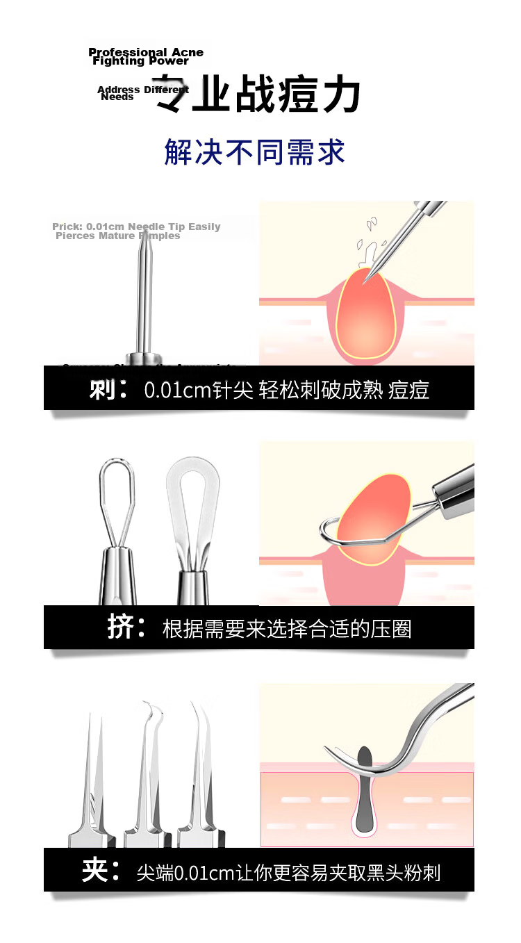 Meifuyu Ultra-Fine No. 5 Blackhead Extractor Tweezers 3-Piece Set for Removing Whiteheads And Acne, Beauty Salon Pimple Extracting Tool MF8725 5