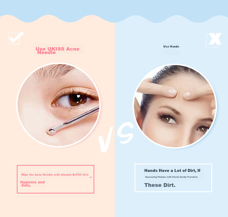 Ukiss Ultra-Fine Blackhead Extractor Tweezers Set of 3, Beauty Salon Tool for Acne, Pimples And Whiteheads, Birthday Gift 2