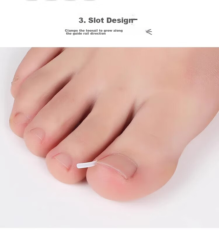 BAHAINIAO Ingrown Toenail Corrector Toe Nail Correction Separator Padding Tool for Ingrown Toenail Trimming 6