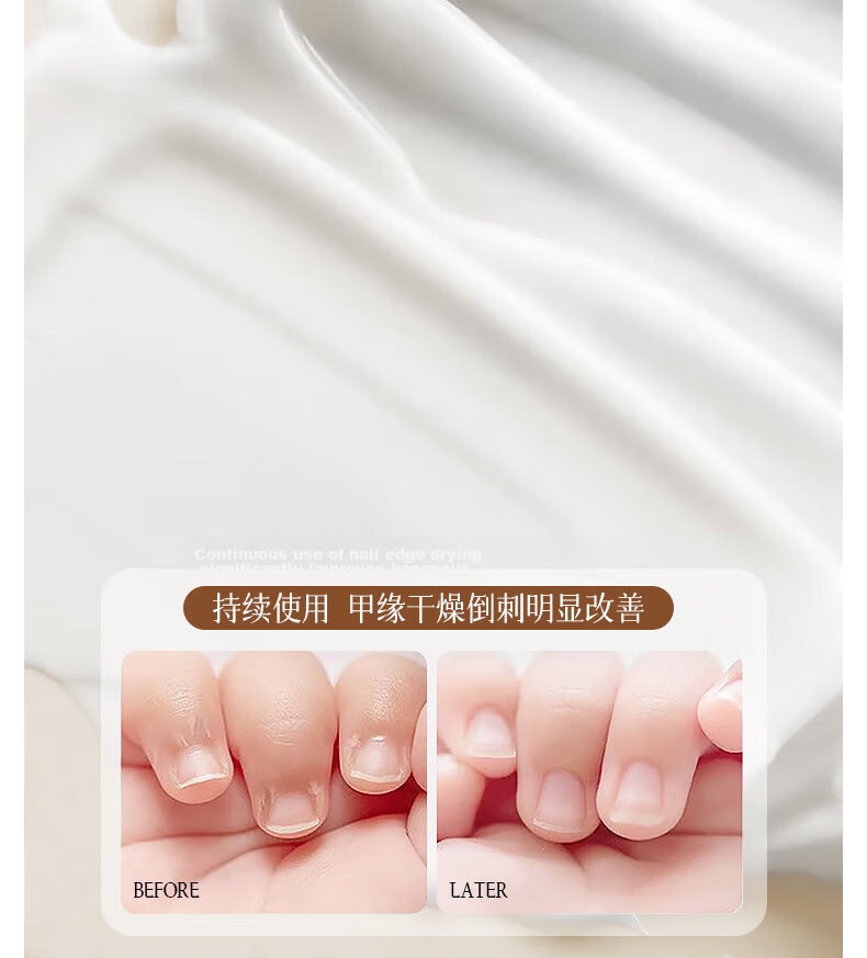 Gemon Paronychia Nail Corrector Ingrown Toenail Correction Tool Toe Nail Straightener Special Nail Clip Patch 6