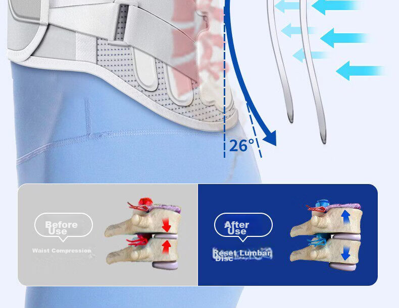 KYOLENS Medical Grade Lumbar Support Belt for Lumbar Disc Herniation, Back Support for Lumbar Muscle Strain, Unisex Waist Pain Relief Brace 6