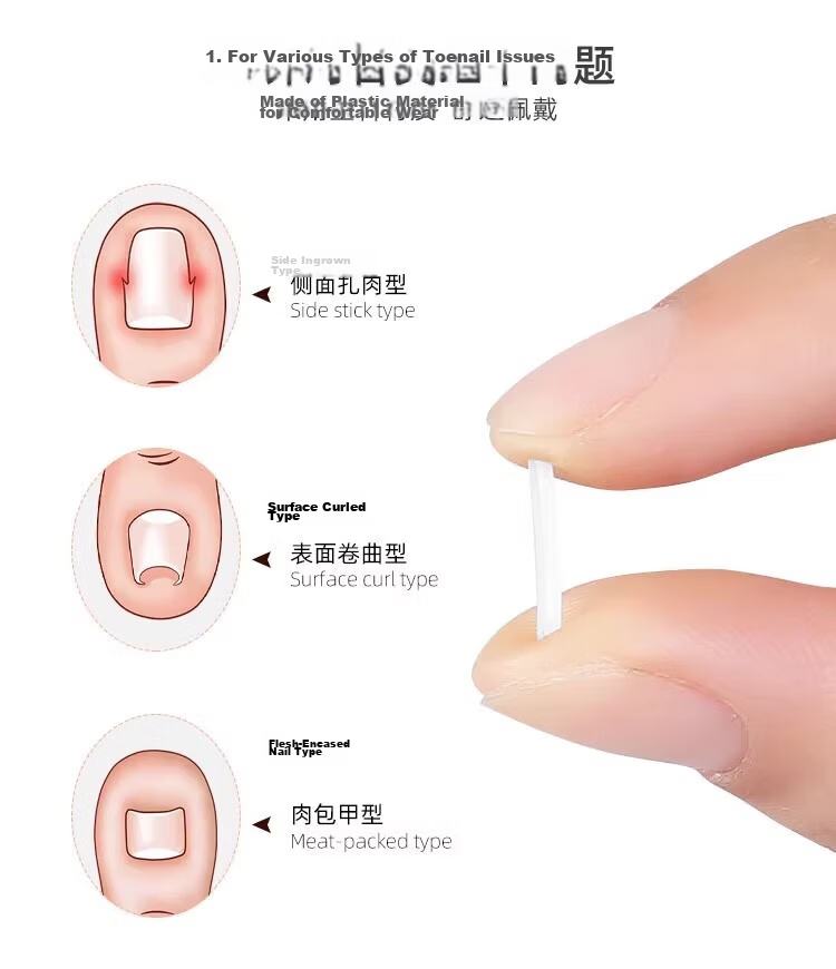 BAHAINIAO Ingrown Toenail Corrector Toe Nail Correction Separator Padding Tool for Ingrown Toenail Trimming 4