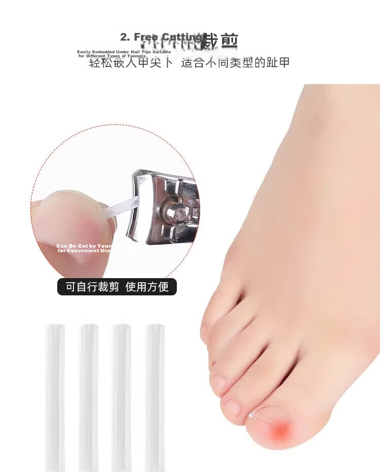 BAHAINIAO Ingrown Toenail Corrector Toe Nail Correction Separator Padding Tool for Ingrown Toenail Trimming 5