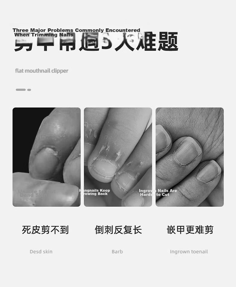 Jinjia German Craft Ingrown Toenail Scissors Original Slant Nail Clippers 2-Piece Household Eagle Beak Podiatry Tool Inflammation Treatment 5