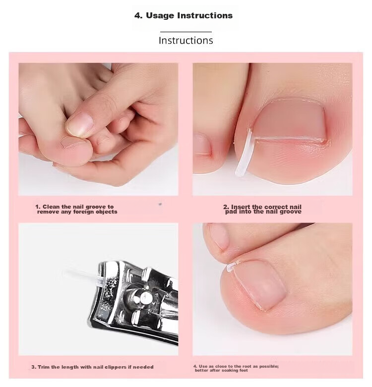 BAHAINIAO Ingrown Toenail Corrector Toe Nail Correction Separator Padding Tool for Ingrown Toenail Trimming 7