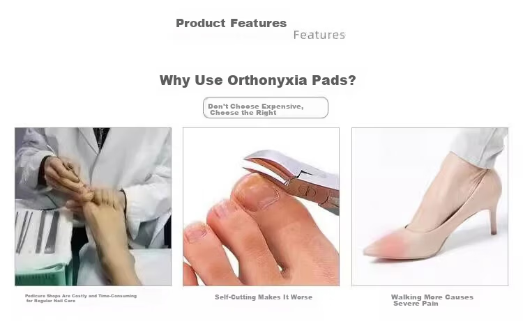 BAHAINIAO Ingrown Toenail Corrector Toe Nail Correction Separator Padding Tool for Ingrown Toenail Trimming 1