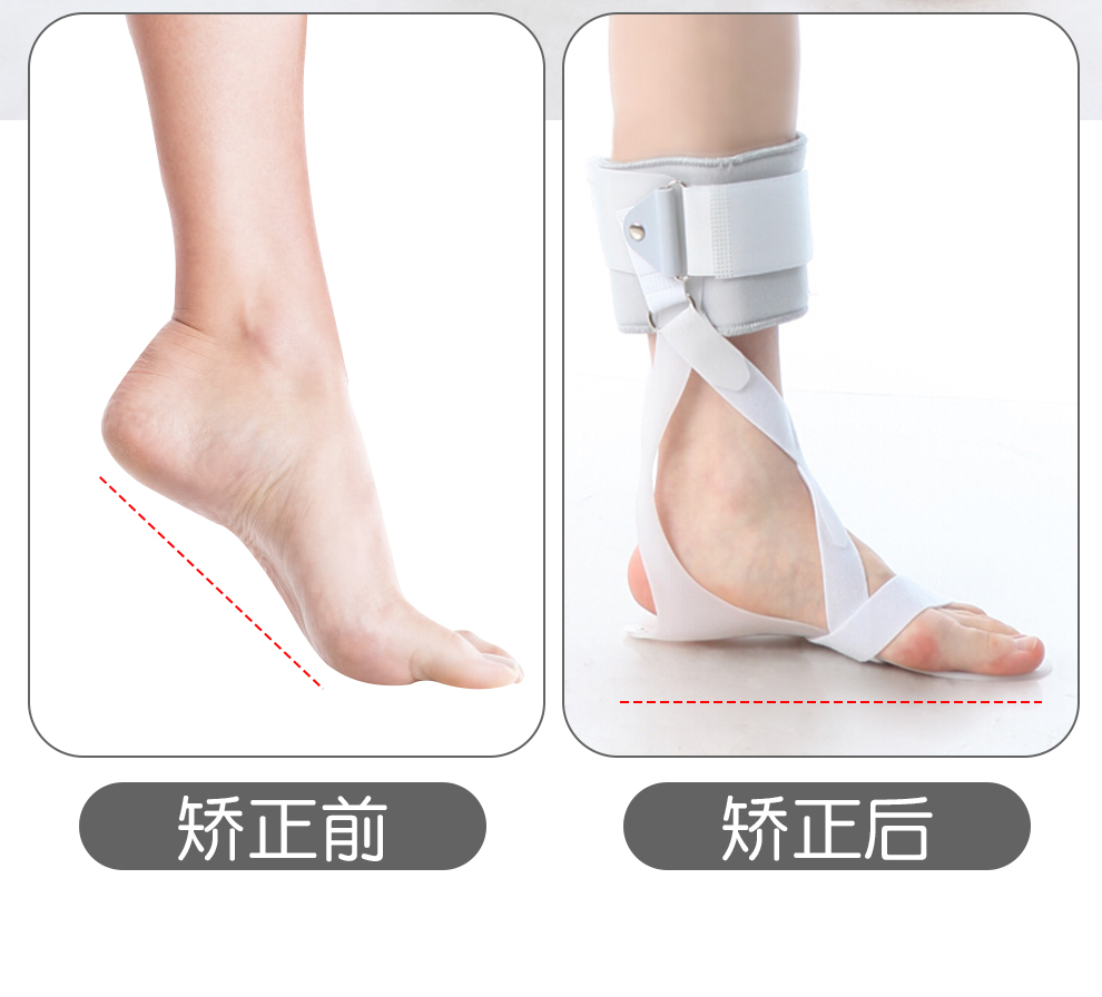 【药房直售】麦德威(medwe)医用足下垂矫正器可穿鞋偏瘫中风康复鞋 足