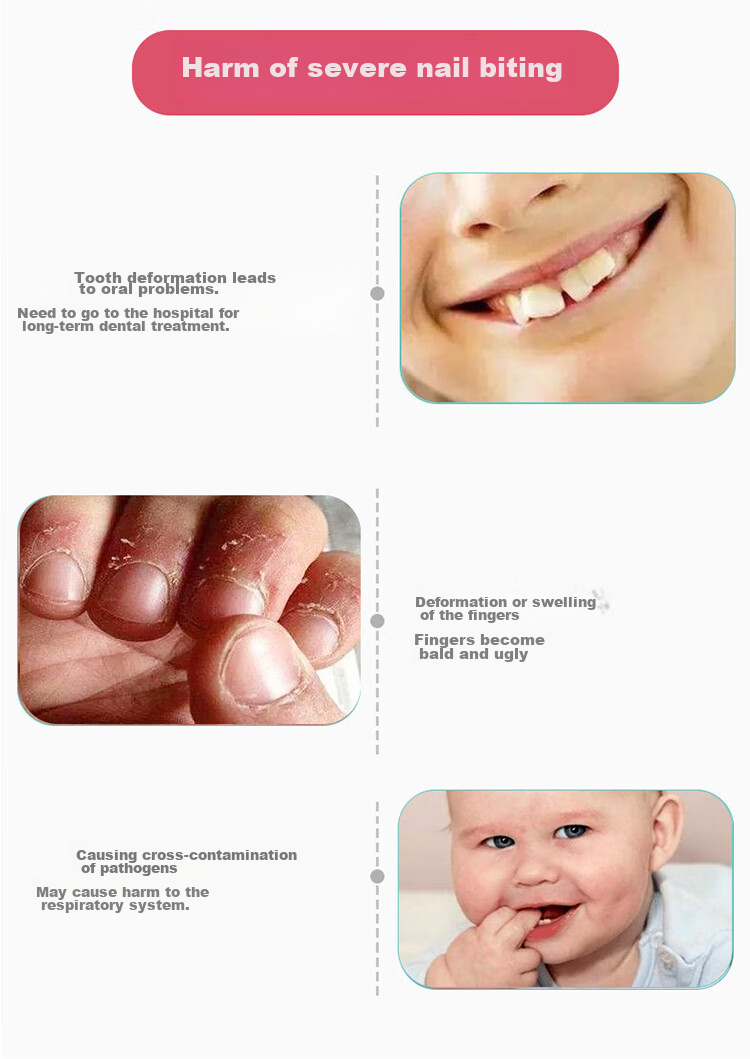 LAXIALIYA Baby Anti-Thumb Sucking Device, Toddler Anti-Biting Gloves, Infant Anti-Sucking Finger, Children's Anti-Thumbsucking Aid, Kids Summer 5
